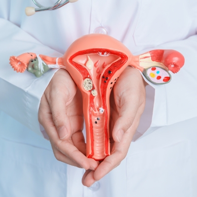 Fondation-recherche-endometriose-miniature